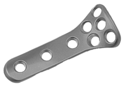 2.4mm Radial Neck Locking Plate